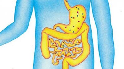 直腸炎治療費(fèi)用是多少錢(qián)